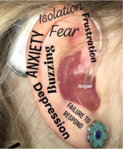 Emotional Impact of Hearing Loss